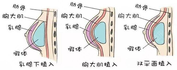项目推荐医生