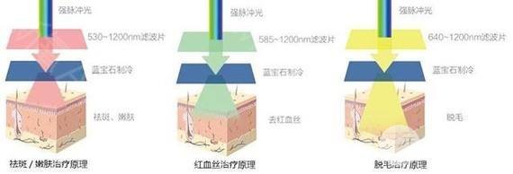 四川华西医院激光技术