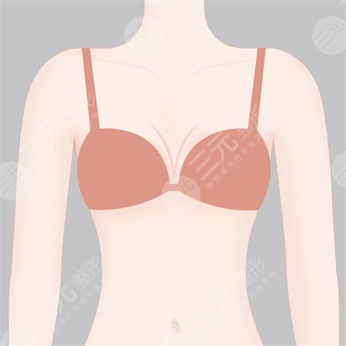 乳房下垂矫正