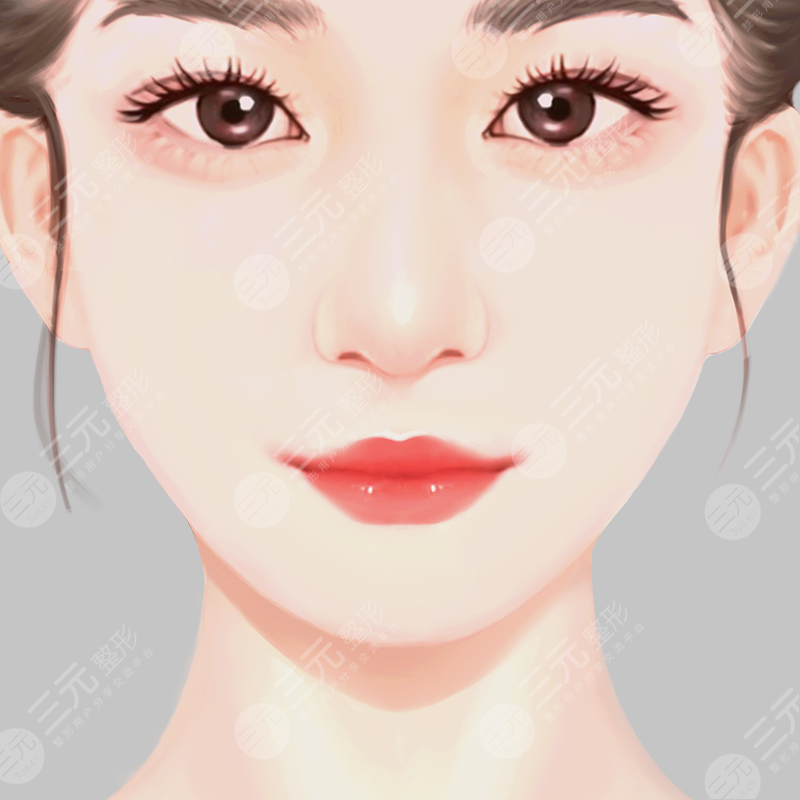 中山二院美容科瘦脸案例