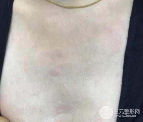 邯郸市中心医院整形科怎么样？价格明细+医生介绍+案例果图~