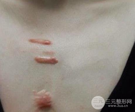 邯郸市中心医院整形科怎么样？价格明细+医生介绍+案例果图~