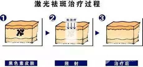 八大处整形美容医院祛痣、祛斑价格表，附案例图