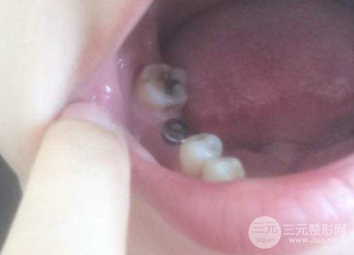 常熟玉蕙口腔医院贵吗