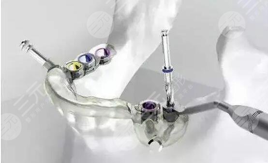 牙齿种植后做好哪些护理事宜?