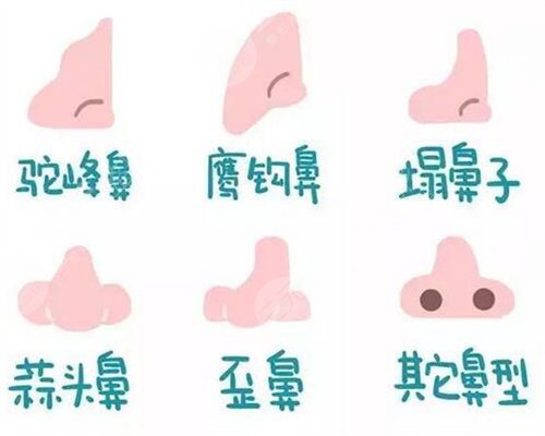 北京隆鼻手术要多少钱|隆鼻整形真人案例对比图