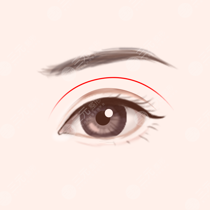 深圳南雅医疗美容好不好？价格表/人气医生介绍/手臂吸脂案例~