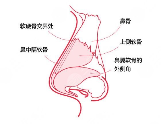 膨体隆鼻手术护理知识