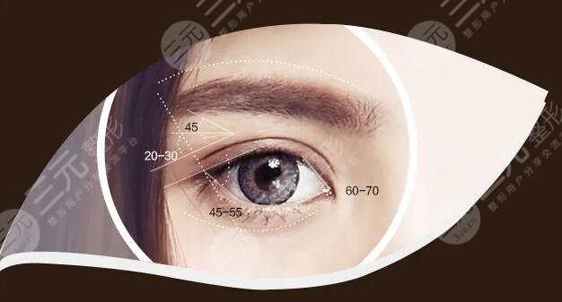埋线双眼皮是什么?