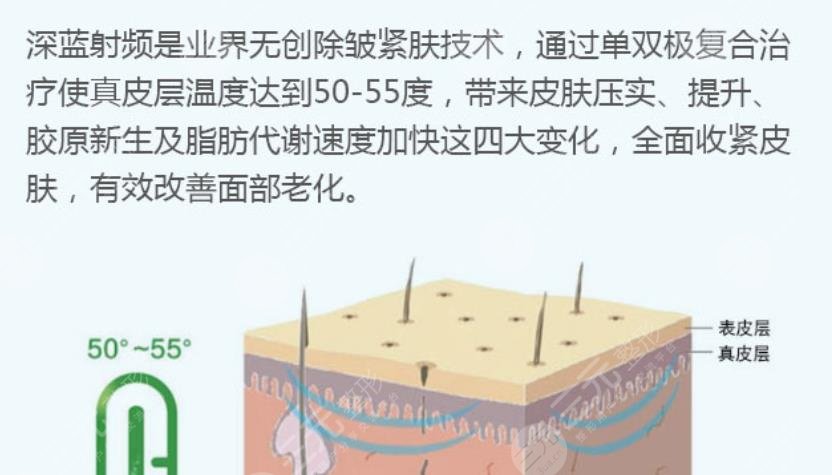 皱纹的深浅程度