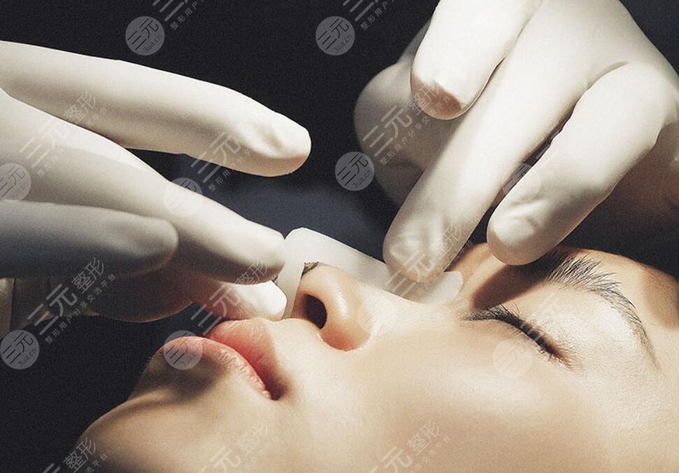 隆鼻手术：