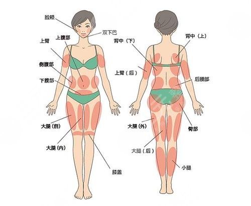 吸脂抽脂手术可以操作哪些部位