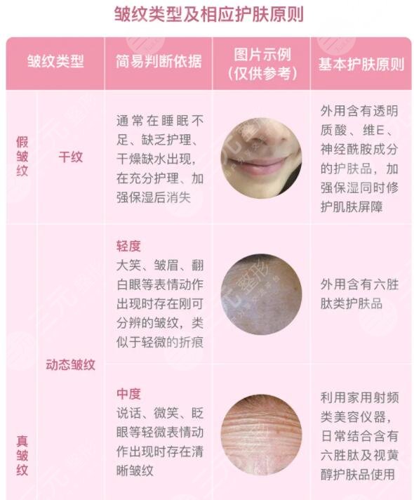 皱纹