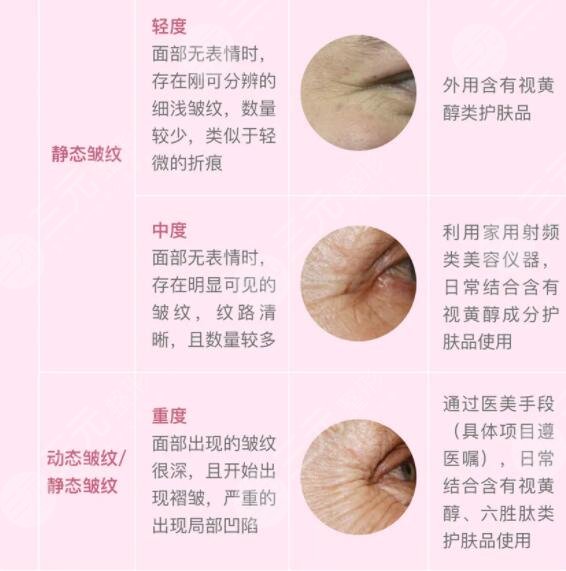 抗衰皱纹