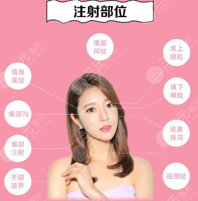 嗨体填充泪沟多少钱一支