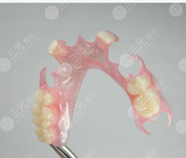 镶牙影响价格的因素