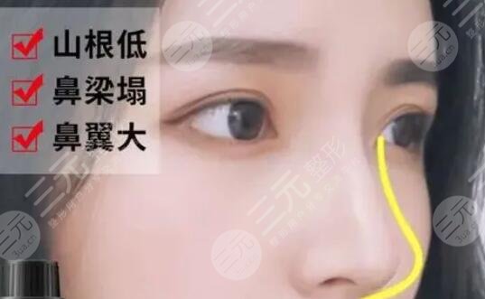 上海9院整形科项目科普