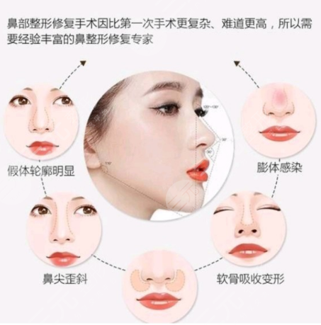 上海9院整形科问答