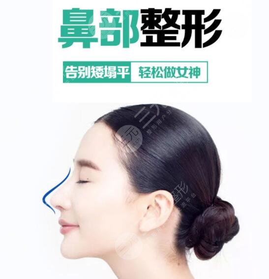 李战强医生隆鼻项目科普