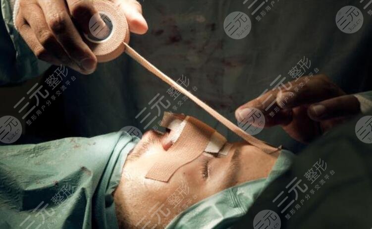 鼻部整形术前需要注意什么