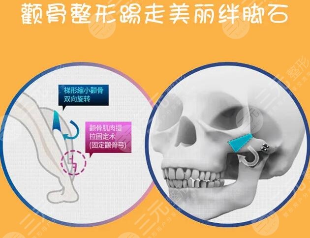 磨颧骨的价格如何