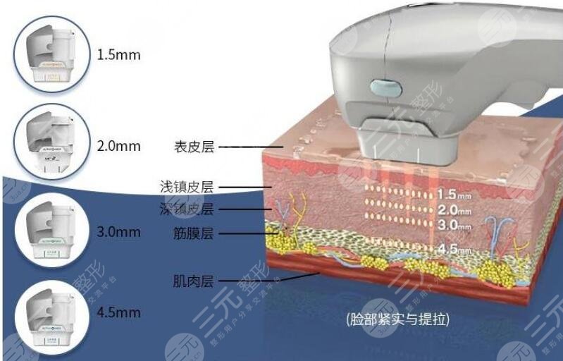 除皱原理