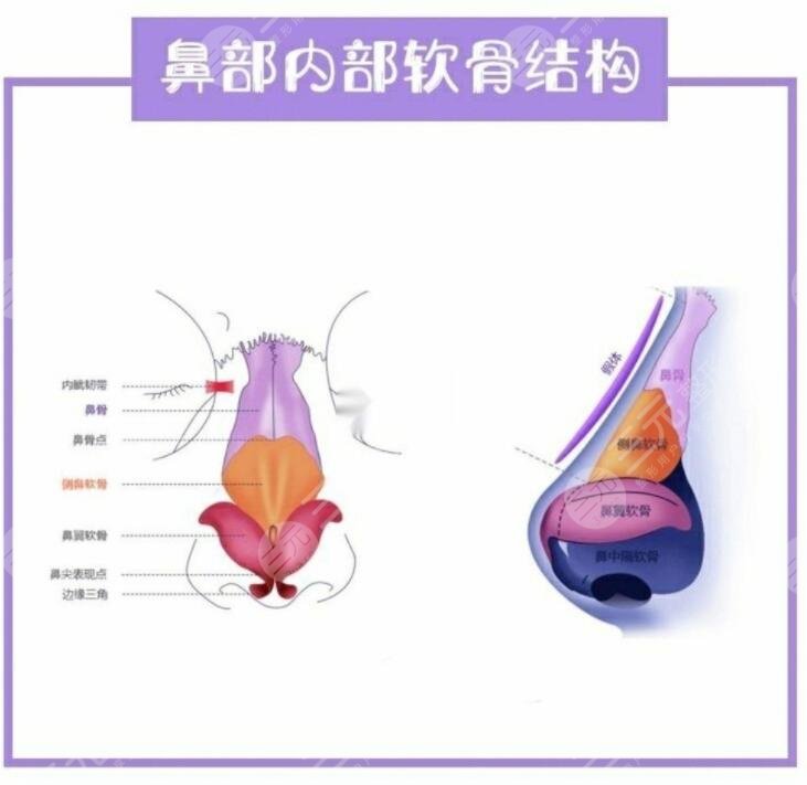 鼻部手术整形前需要注意哪些