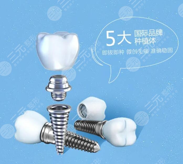 牙齿种植手术需要多久恢复