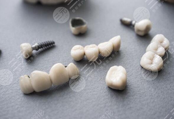 南京种植牙多少钱一颗2025