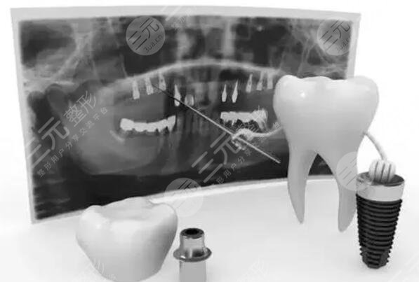 哪些人不能做牙齿种植?