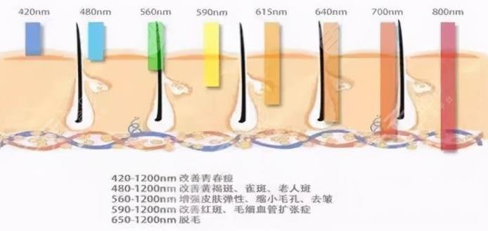 光子嫩肤有哪些功?
