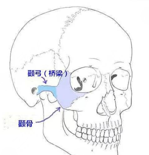 磨颧骨手术疼不疼