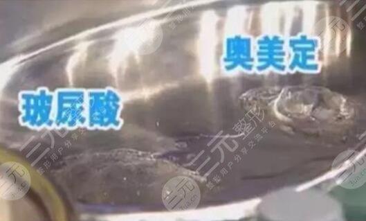 奥美定取出注意事项