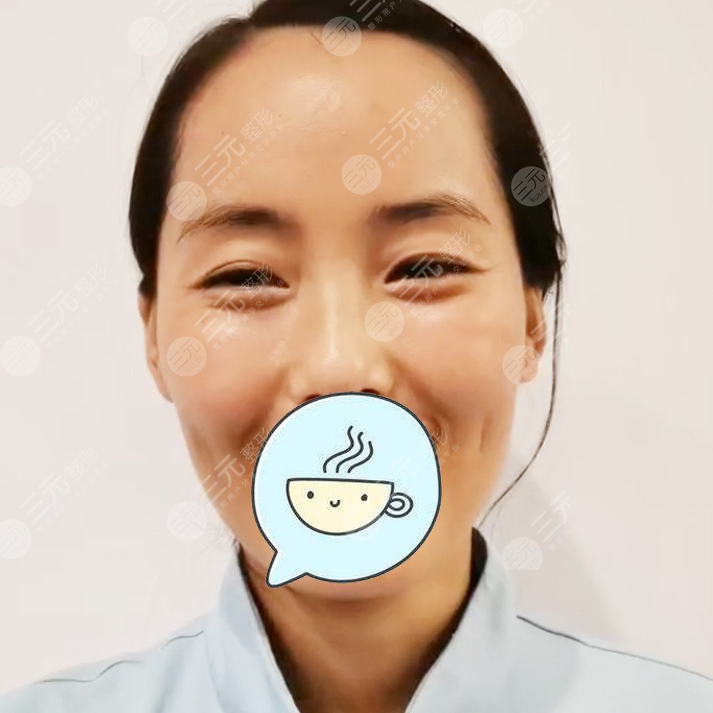 武汉美基元做热玛吉怎么样