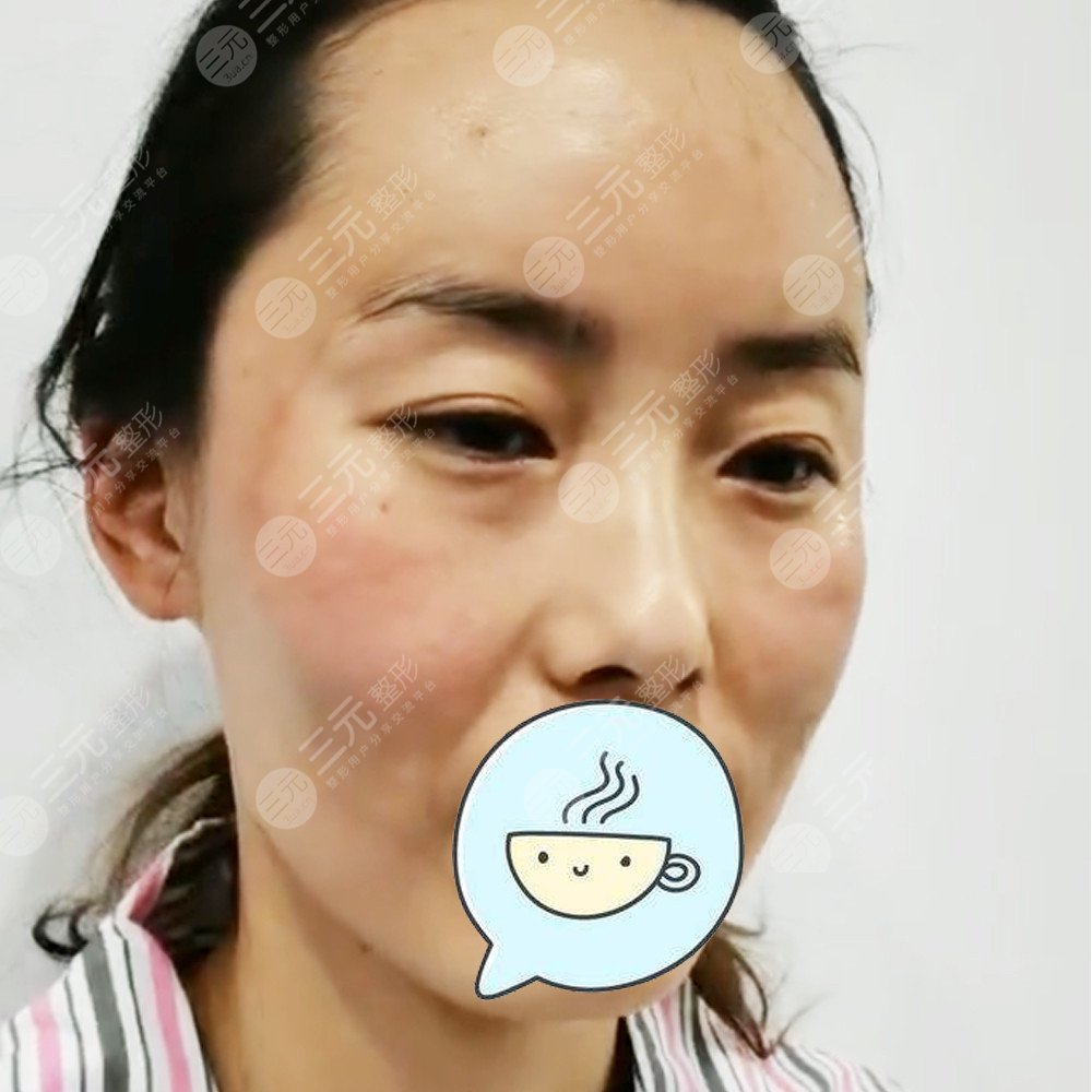 武汉美基元做热玛吉怎么样