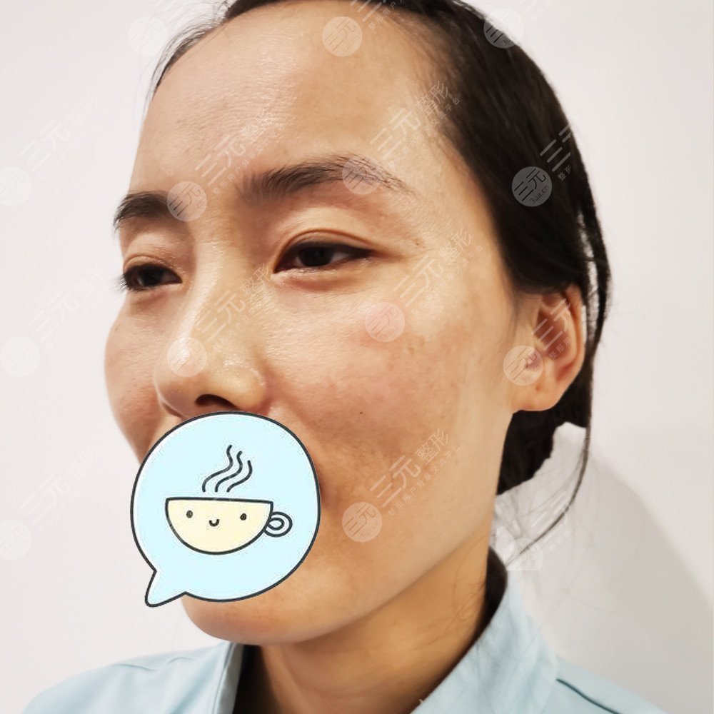 武汉美基元做热玛吉怎么样