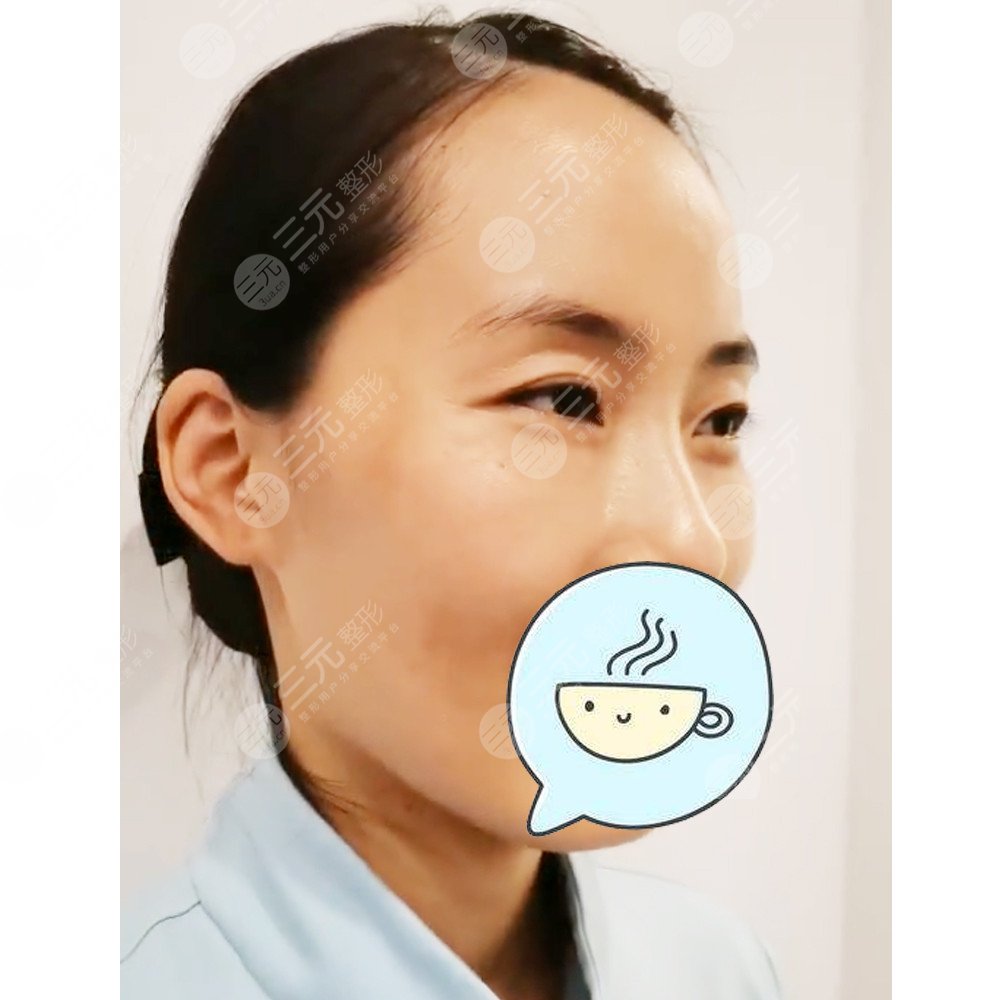 武汉美基元做热玛吉怎么样