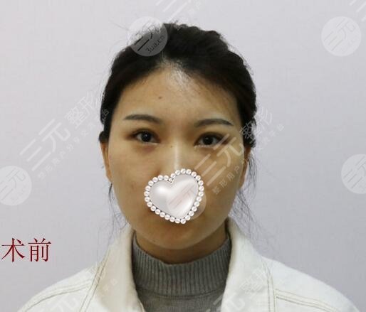 武汉第一医院热玛吉多少钱