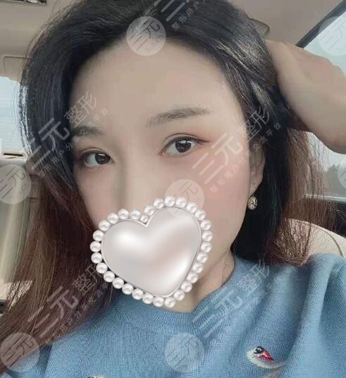 武汉第一医院热玛吉多少钱