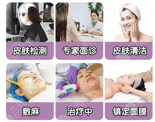 做一次热玛吉多少费用