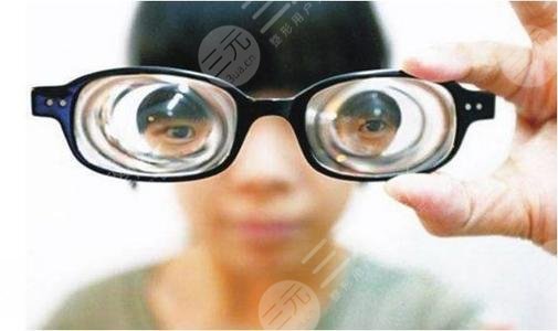 成都近视眼手术费用参考