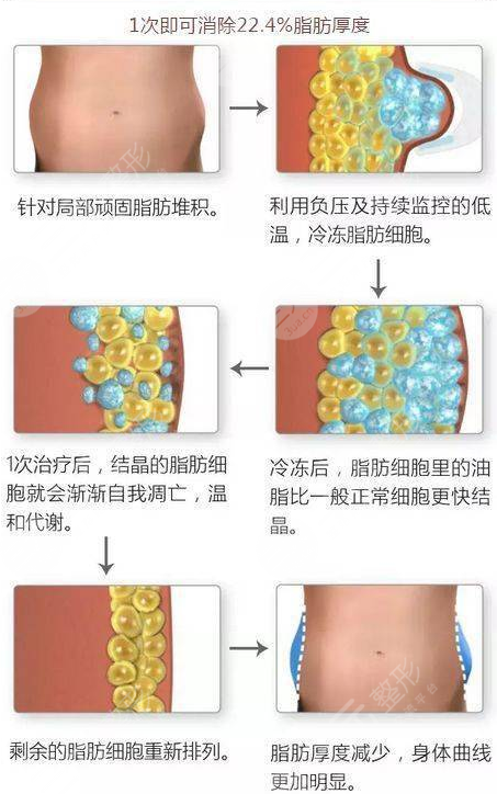 溶脂过程