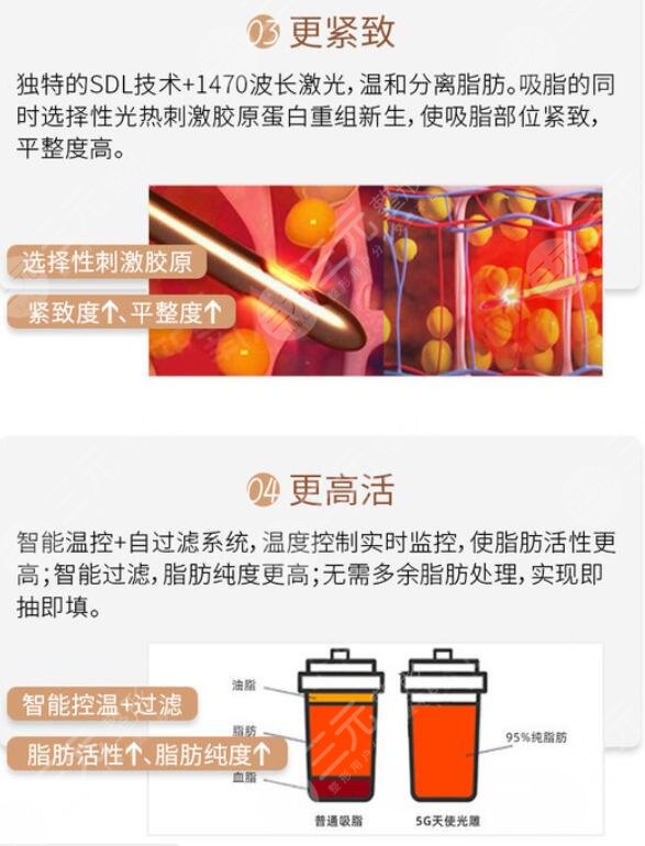吸脂优势