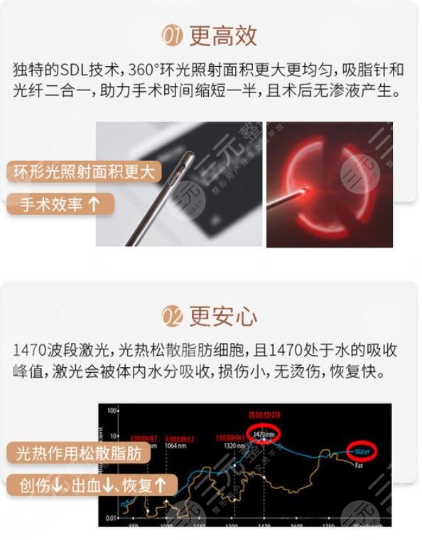 什么原因影响了5G天使光雕吸脂术价格