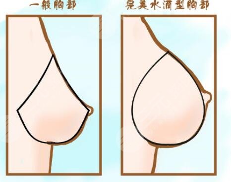 胸部标准