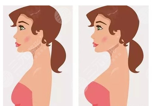 奥诺拉璀璨水滴是什么意思