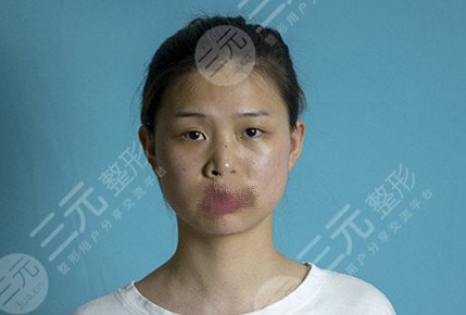 哈尔滨211美容科整形崭新价目表来袭！跟我一起来揭秘这家医院吧