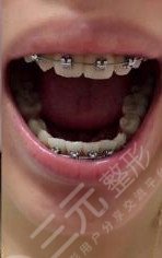 中南大学湘雅口腔医院牙齿正畸中
