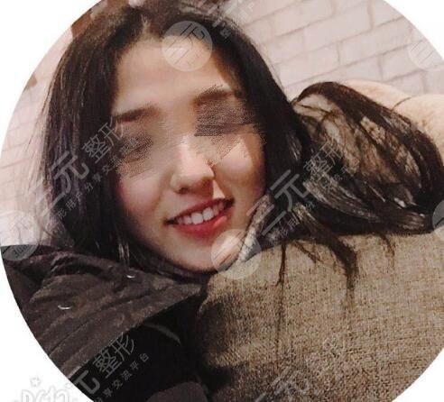 光华口腔医院牙齿矫正案例