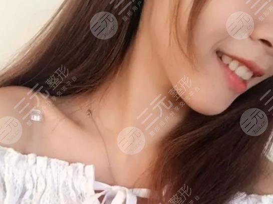 佛山市第一人民医院口腔科牙齿矫正分享